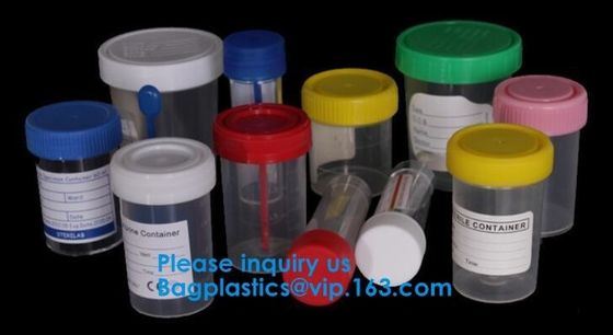 Medical Use Sterile Urine And Stool Sample Container 30ml 40ml 60ml 100ml,Disposable Urine Test Bottles For Medical Cont